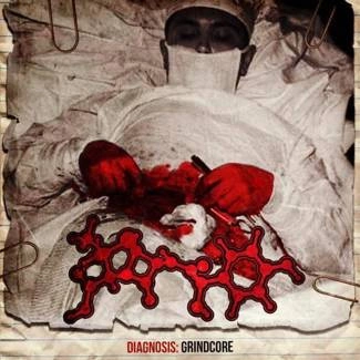 AMOCLEN Diagnosis: Grindcore CD